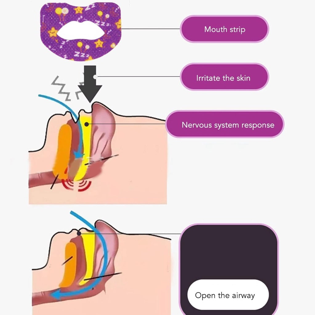 Kids Adults Anti-Snoring Sticker